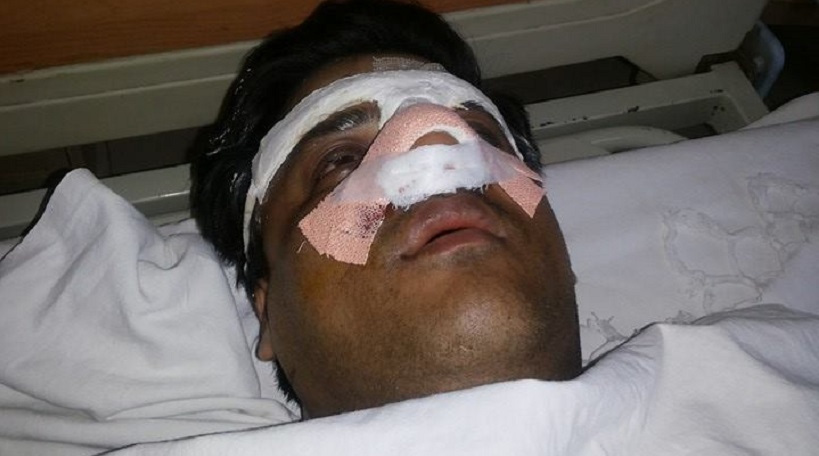 images_0abc_ashwini2 | No. 1 Indian Media News Portal