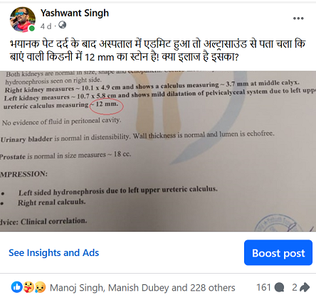 Kideny_stone_story1 | No. 1 Indian Media News Portal