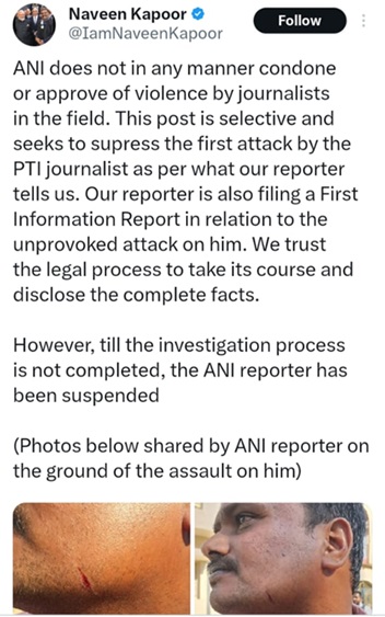 anin | No. 1 Indian Media News Portal