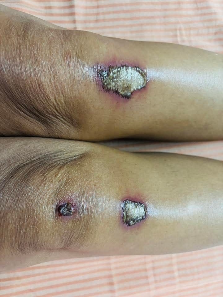 ramdutt injury | No. 1 Indian Media News Portal