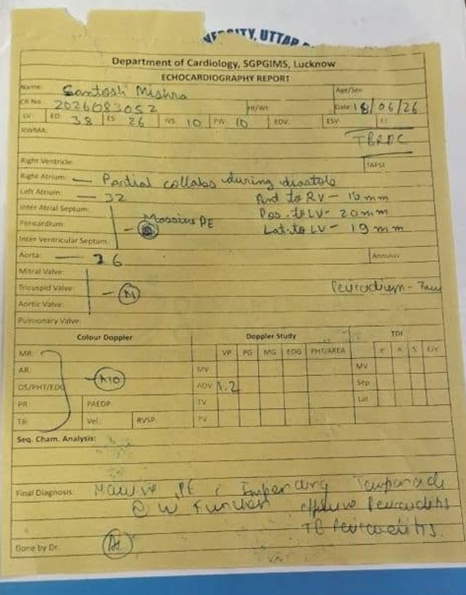 Yellow echocardiography report form from the Department of Cardiology, SGPGIMS Lucknow, with handwritten patient details, measurements, and medical notes.