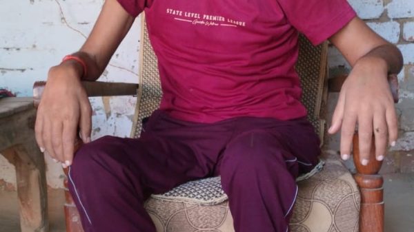 Adult man seated in a worn armchair outdoors, wearing a magenta T‑shirt and purple pants, with a nasal oxygen tube.