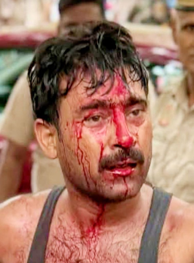 lathicharge | No. 1 Indian Media News Portal Man with bloodied face and neck, wearing a gray tank top, in an outdoor setting with bystanders nearby
