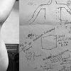 Arm with many small dark marks next to a whiteboard filled with hand-drawn diagrams and notes.