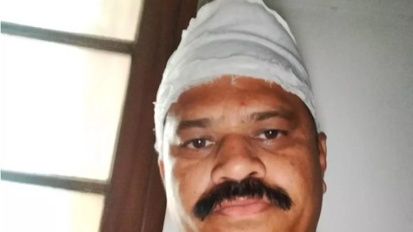 Close-up of a man with a white head wrap/bandage and a mustache, looking at the camera indoors.