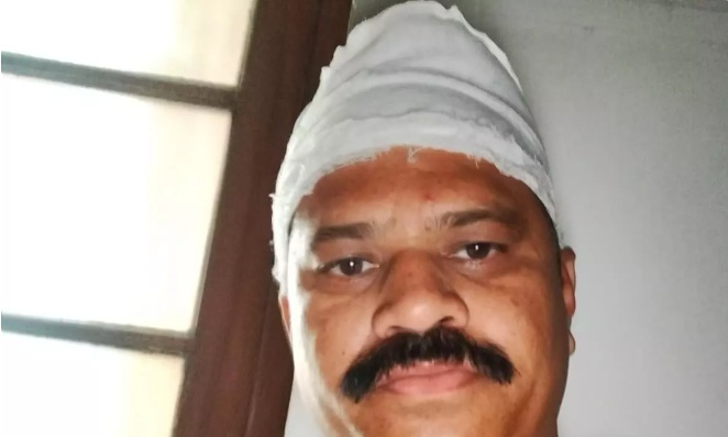 Close-up of a man with a white head wrap/bandage and a mustache, looking at the camera indoors.