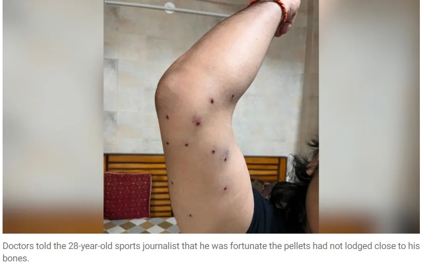 Raised arm showing multiple small pellet-entry wounds along the upper arm.