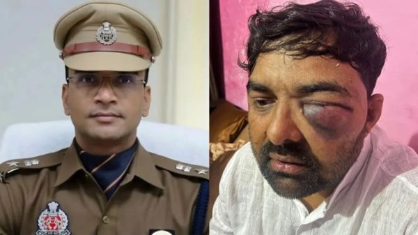 Side-by-side photo: a uniformed police officer in khaki with cap on left; a man with a swollen eye and bruised face on the right.