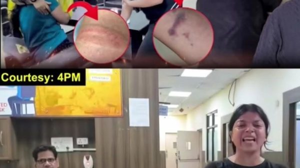 Collage: injured person with bruised knee in a hospital setting and a reporter covering a scene nearby; arrows highlight the wounds in zoomed-in insets.