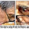 Two close-up portraits of an elderly man wearing glasses, shown side by side, focusing on his eyes and facial features.