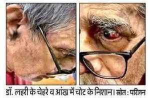 Two close-up portraits of an elderly man wearing glasses, shown side by side, focusing on his eyes and facial features.