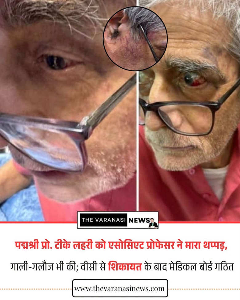 tk lahiri_1 | No. 1 Indian Media News Portal Split-screen news photo of two men wearing glasses; one with a bruised cheek, the other with a red eye, with an inset circle highlighting an ear injury being treated; The Varanasi News banner and Hindi headline below.