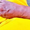 Close-up of a hand resting on bright yellow fabric.