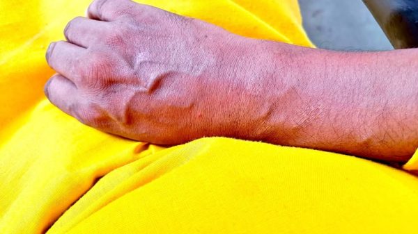 Close-up of a hand resting on bright yellow fabric.