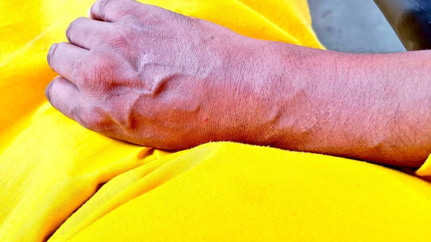 gaurav agra | No. 1 Indian Media News Portal Close-up of a hand resting on bright yellow fabric.