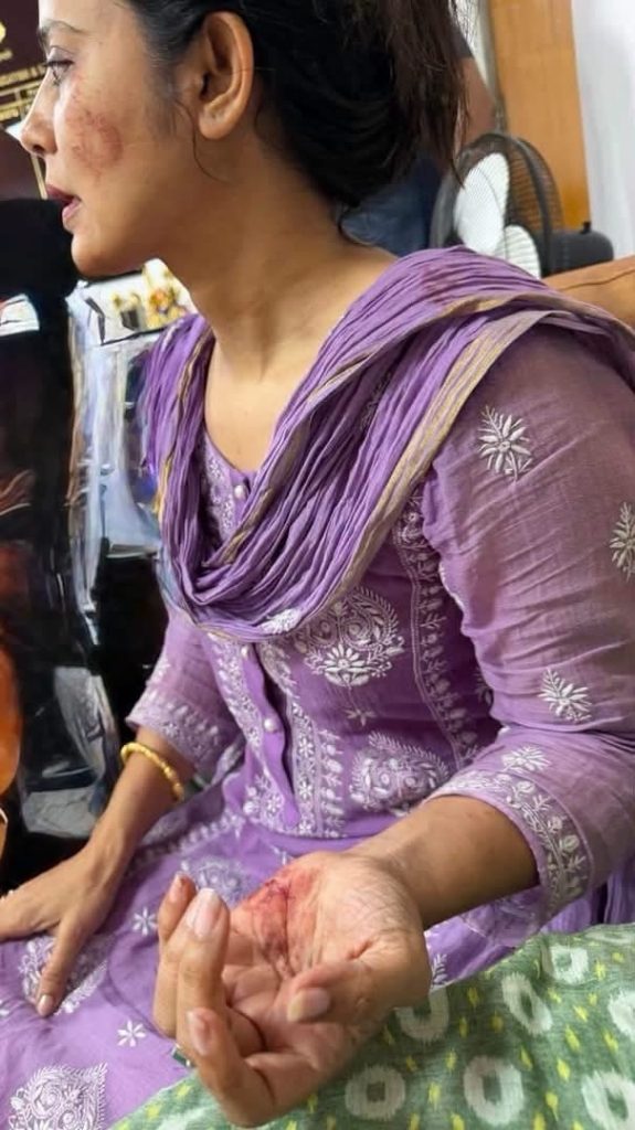 img_1897 | No. 1 Indian Media News Portal Woman in a purple embroidered outfit shows facial bruising and a scraped, injured palm on her hand.
